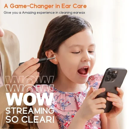 Bebird R1Pro Ear-Cleaning Camera - Image 6